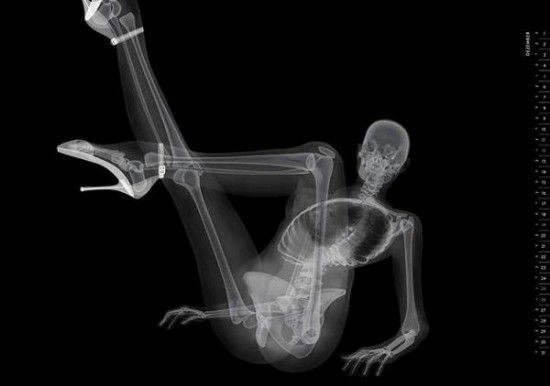 Šis eksistē: rentgena piespraužamais kalendārs [attēli]