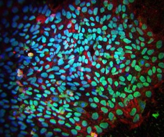 Den væsentligste forskel mellem opdagede stamceller fra embryonale og inducerede stamceller kan gøre behandlinger mere sikre